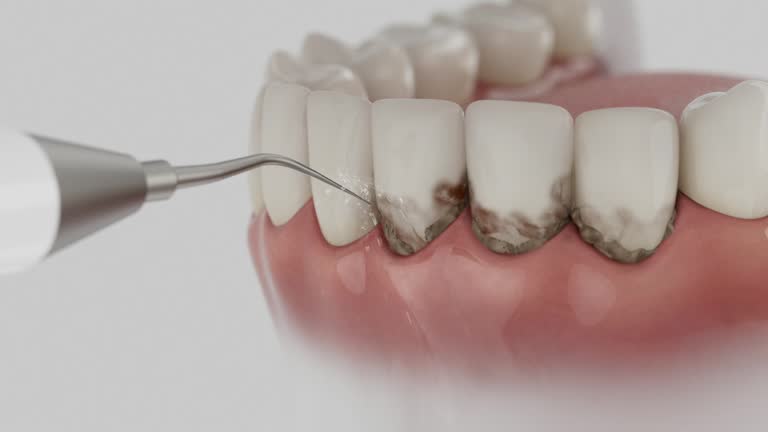 Reliable Dental Implants contractor in Bottineau, ND by Smile Center Dentistry